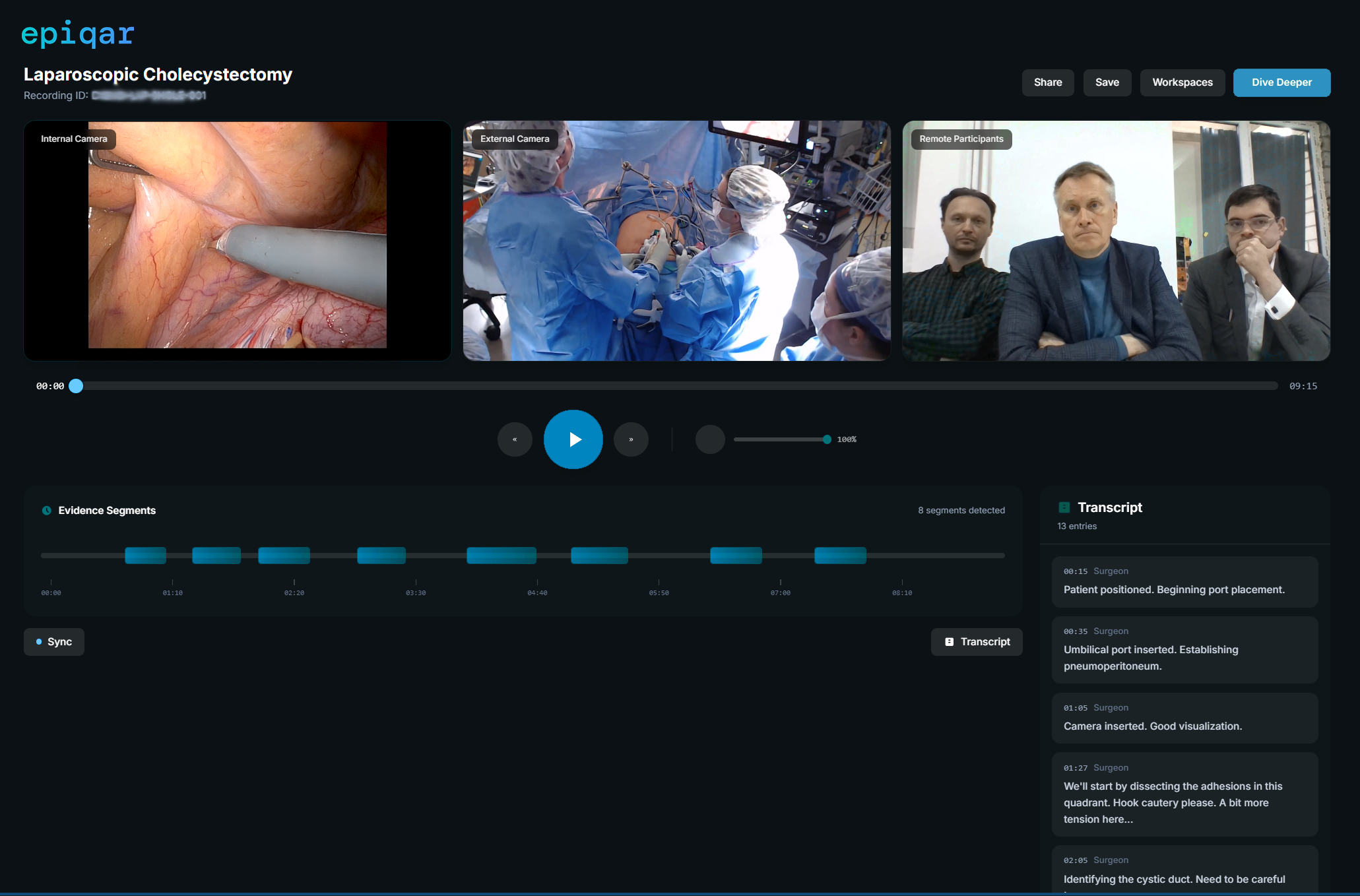 epiqar Deep Dive AI interface showing evidence segments, synchronized transcript, and multi-camera surgical review