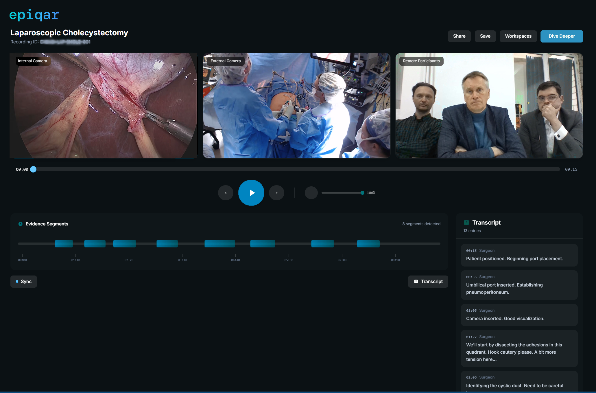 epiqar Deep Dive AI interface showing evidence segments, synchronized transcript, and multi-camera surgical review