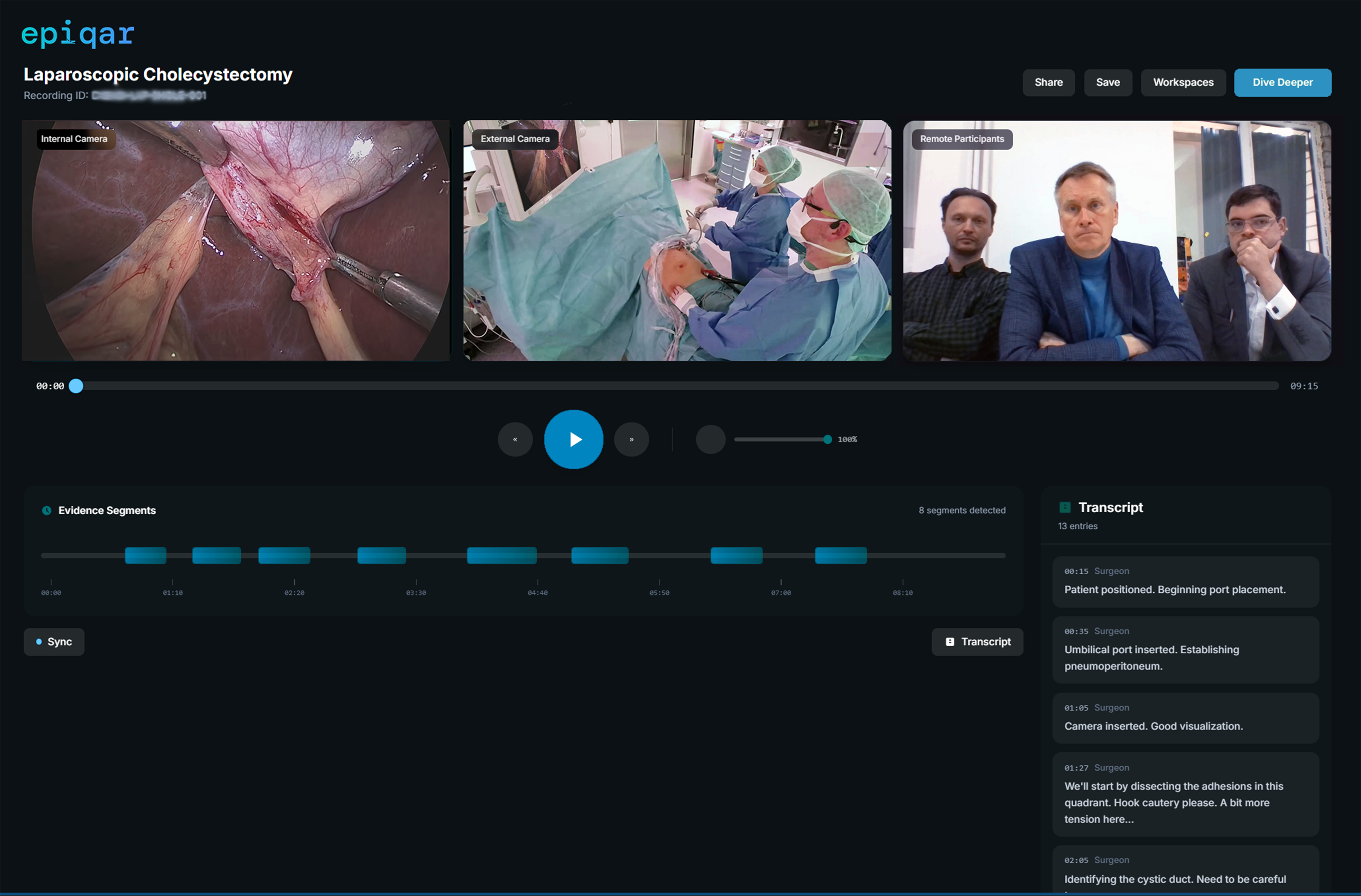 epiqar Deep Dive AI interface showing evidence segments, synchronized transcript, and multi-camera surgical review
